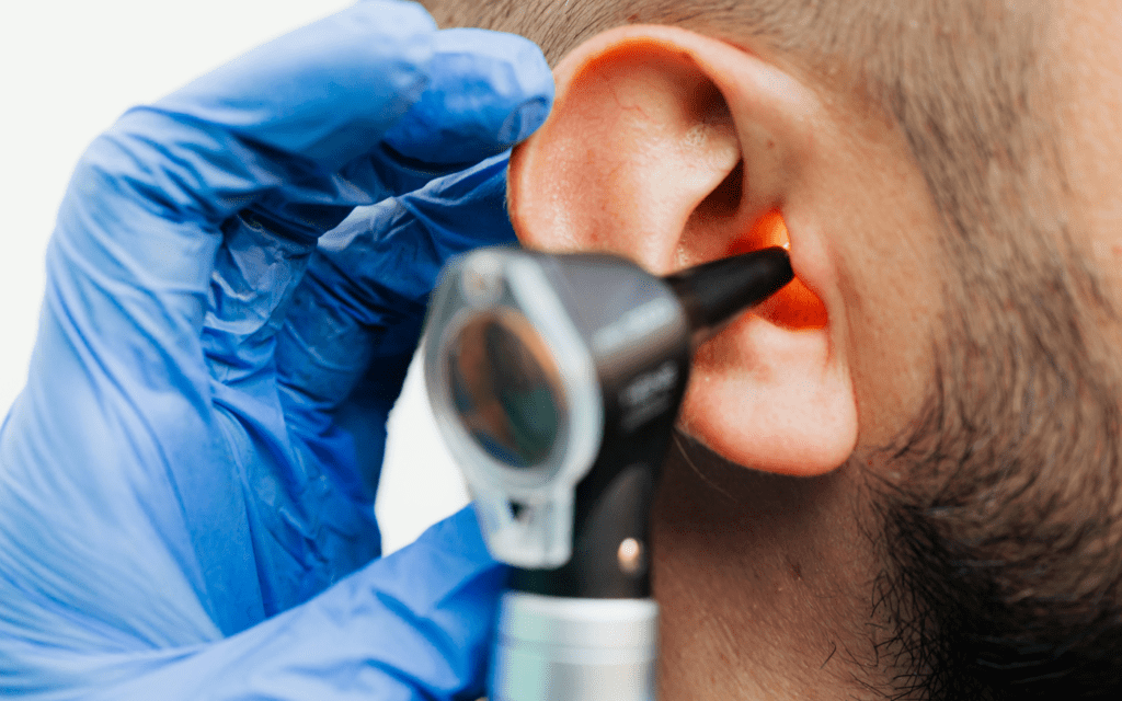  Ear infection (Otitis)